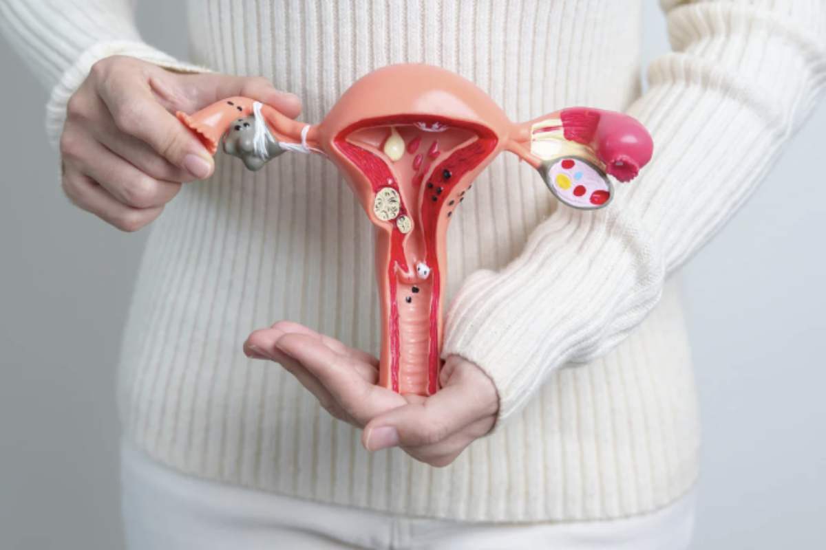Mentre la ricerca scientifica avanza, molte donne continuano a incontrare ostacoli significativi nel percorso diagnostico e terapeutico.