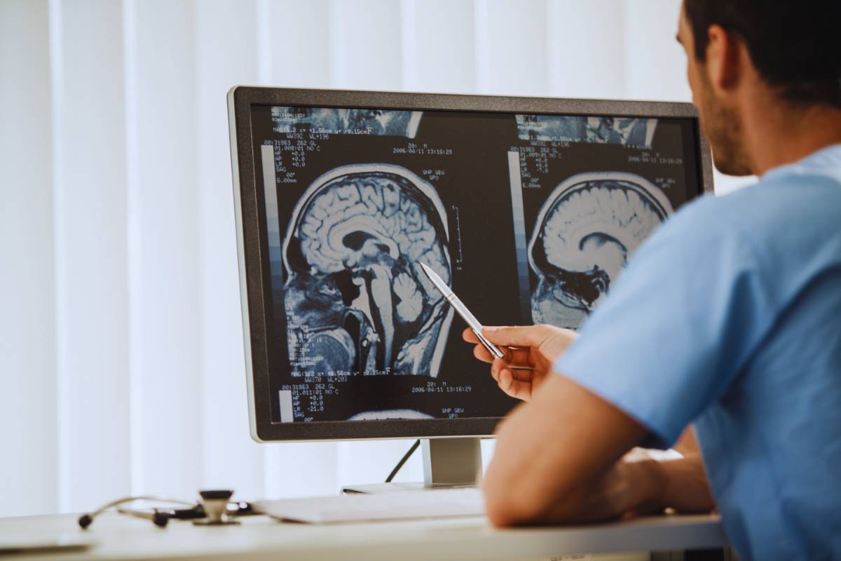 Tumore al cervello: il nuovo sintomo che compare decenni prima