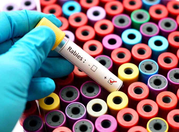 rabbia, arriva in italia sintomi e causa